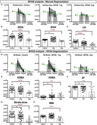 Quantitative Phenotyping of Xenopus Embryonic Heart Pathophysiology Using Hemoglobin Contrast Subtraction Angiography to Screen Human Cardiomyopathies